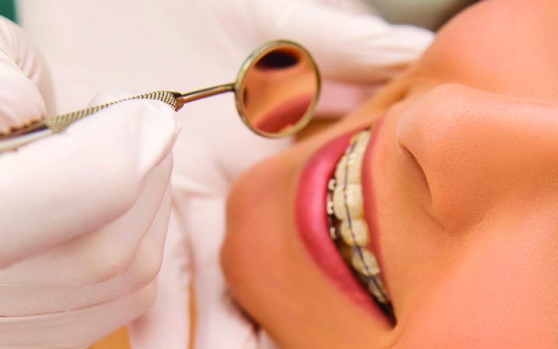 Cosmetic Dentistry Lake Worth