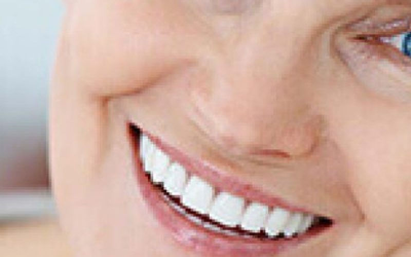 Cosmetic Dentist Lake Worth